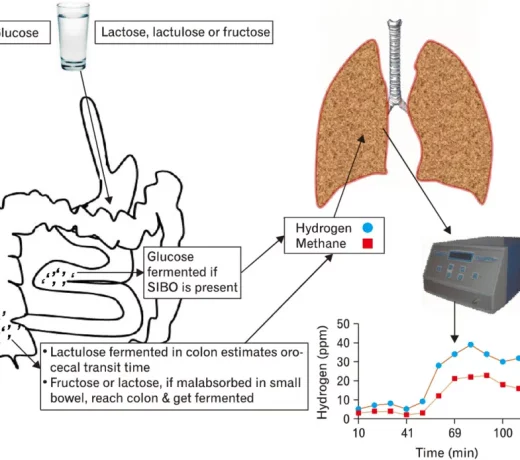 Breath test