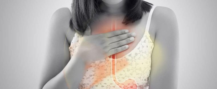 Acid reflux pain