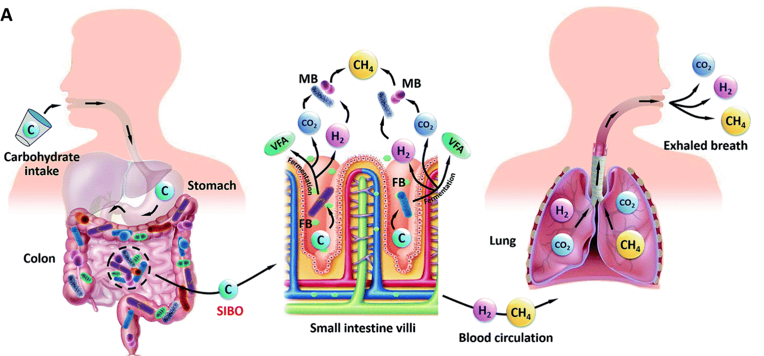 Gas disposal from gut